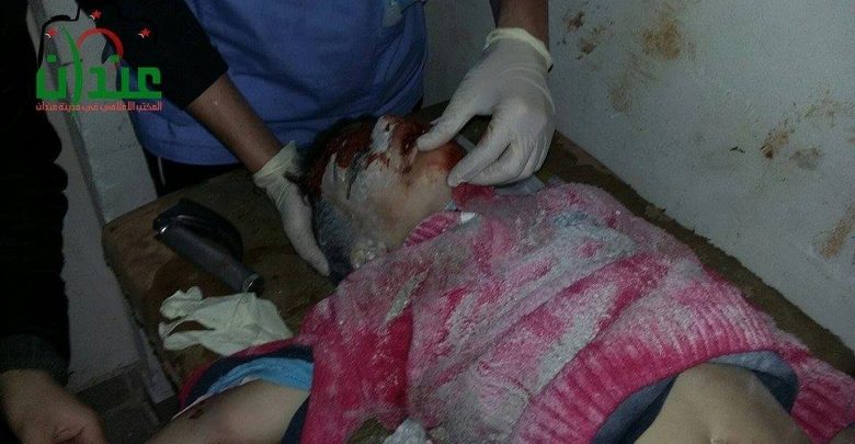 أحد الأطفال الجرحى نتيجة سقوط صاروخ سكود على مدينة حريتان بريف حلب الشمالي